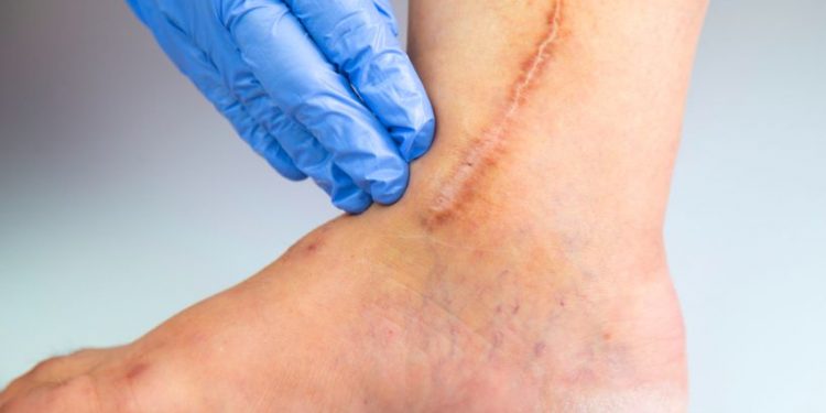 Postoperative Pain Symptoms and Treatments