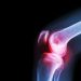 Septic Arthritis