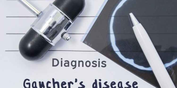How to Manage Gaucher’s Disease Symptoms