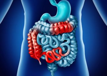 Hirschsprung Disease Symptoms