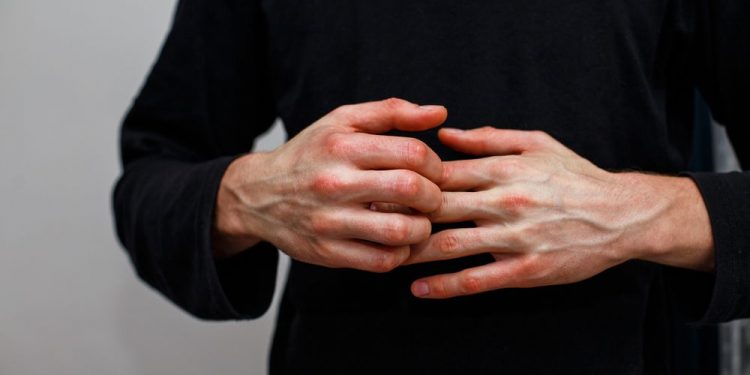 Autoimmune Disease Symptoms