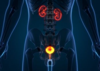 Stage 4 – Advanced Prostate Cancer