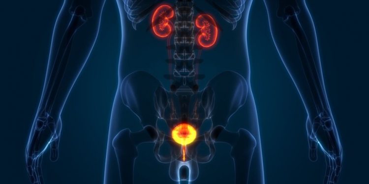 Stage 4 – Advanced Prostate Cancer