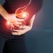 Treatments for Stage 3 Colon Cancer