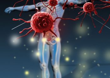 Vasospastic Diseases Symptoms