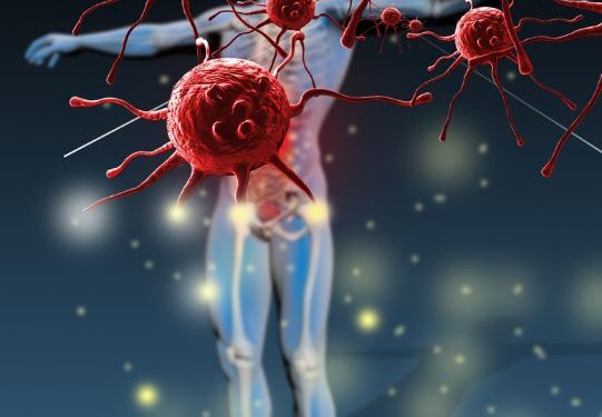 Vasospastic Diseases Symptoms