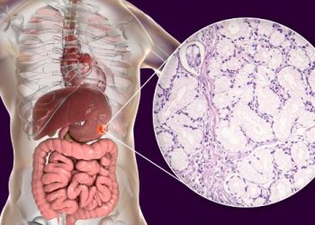 Gastric Cancer Treatment