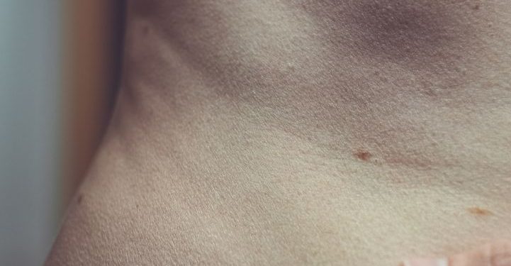 Abdominal Wall Congenital Malformations