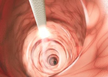 Colorectal Cancer Symptoms and Screening