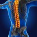 Spinal Abscess Symptoms and Diagnosis