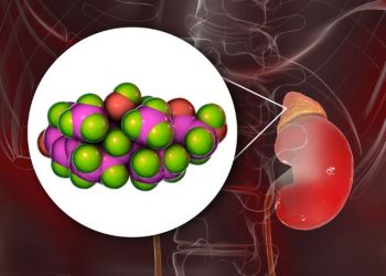 Addison’s Disease Symptoms