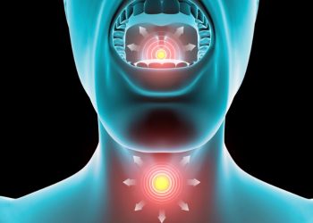 Mononucleosis Symptoms and Treatment