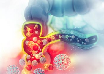 What is a Colorectal Polyp?