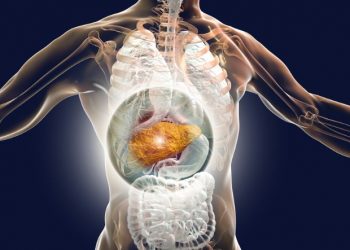 Hepatocellular Carcinoma