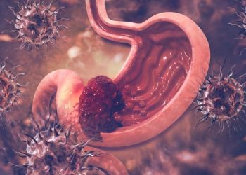 Stomach Cancer – What You Need to Know