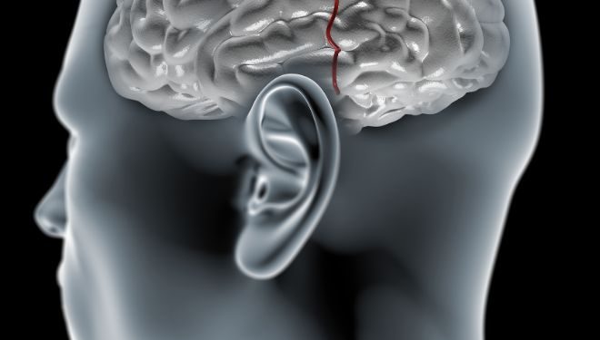 What Are Congenital Malformation Symptoms?