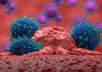 Burkitt Lymphoma Symptoms and Treatment