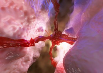 Pituitary Tumors Treatment