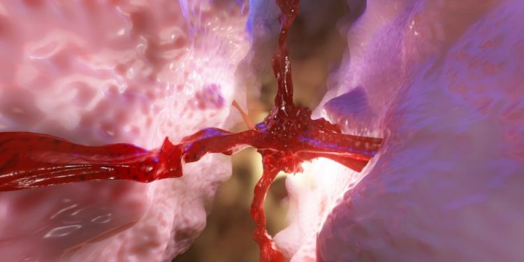 Pituitary Tumors Treatment