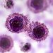 Malignant Mesothelioma Symptoms