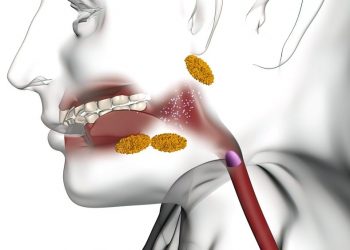 Non-Neoplastic Diseases of the Salivary Glands