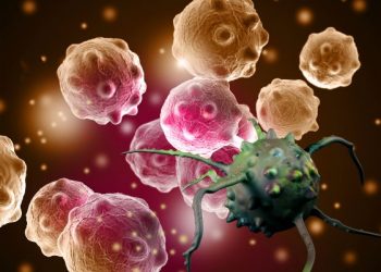 Life Expectancy for Stage 4 Cancer