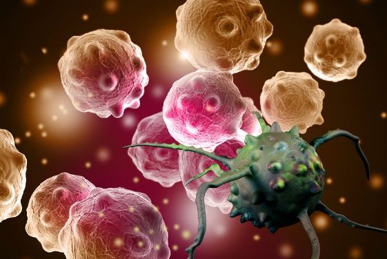 Life Expectancy for Stage 4 Cancer