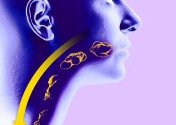 Salivary Glands Disease and Tumors Symptoms