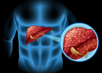 Liver Cancer Treatment
