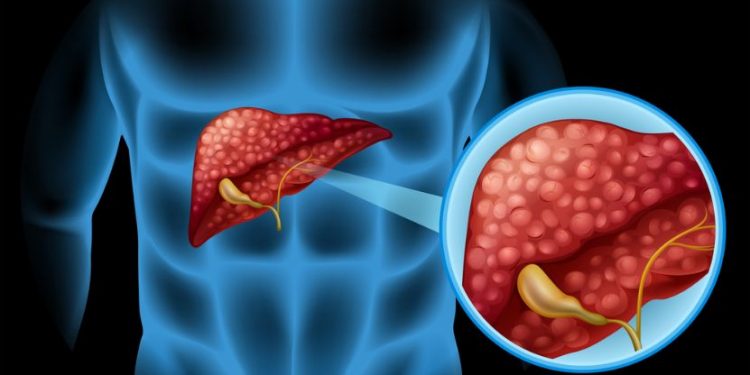 Liver Cancer Treatment