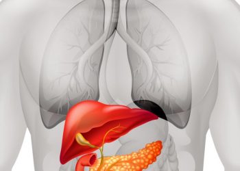 Stage 4 Liver Cancer