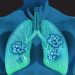 Life Expectancy for Stage IV Lung Cancer