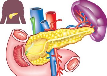 Different Types of Pancreatic Cancer Treatment