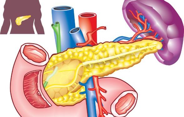 Different Types of Pancreatic Cancer Treatment