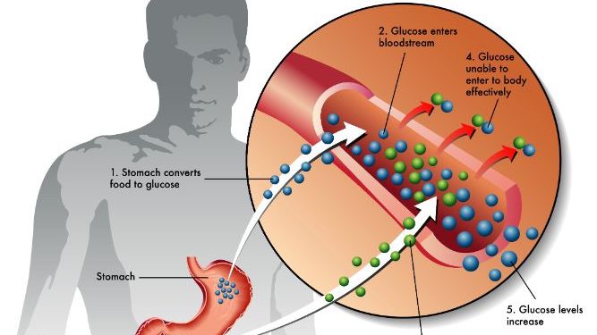 Glycogen Storage Diseases Symptoms
