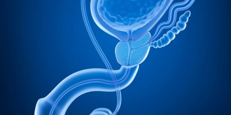 Treatments for an Enlarged Prostate