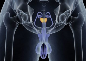 How PSA Levels Can Help Determine If a Man Should Have a Digital Rectal Exam Or a Prostate Biopsy