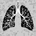 Stage 4 Lung Cancer Symptoms of Dying