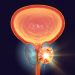 How to Treat a Prostate Infection