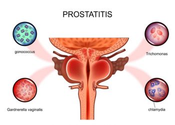 What You Need to Know About Prostate Size