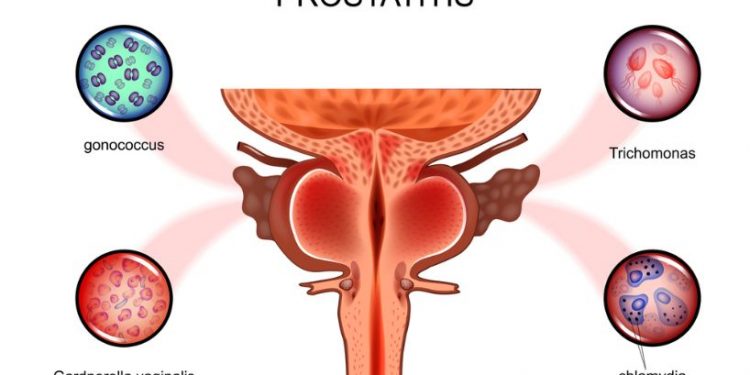 What You Need to Know About Prostate Size