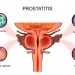 What You Need to Know About Prostate Size