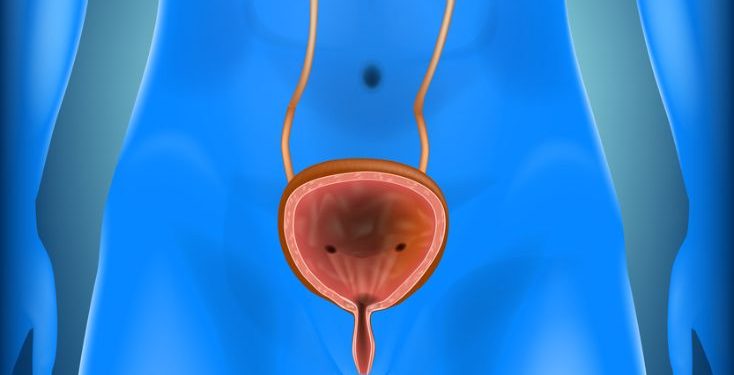 Types of Prostate Cancer Treatment