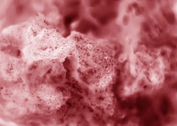 Metastatic Lung Cancer