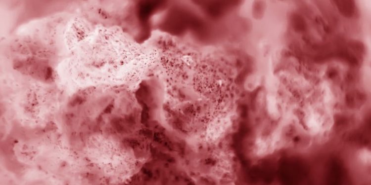 Metastatic Lung Cancer