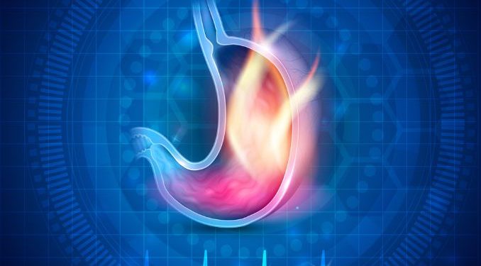 Stomach Cancer Symptoms