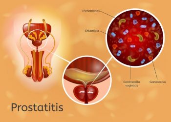 Benign Prostatic Hyperplasia