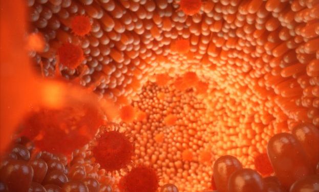 Stage 1 Stomach Cancer Symptoms Female