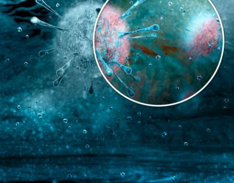 What Are Liver Metastases?