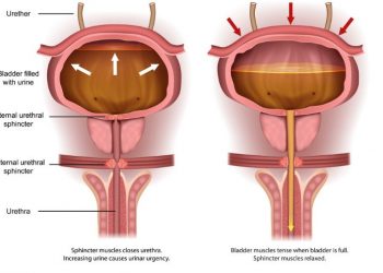 What is Prostate Specific Antigen (PSA)?